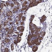 Anti-AAK1 antibody produced in rabbit Prestige Antibodies® Powered by Atlas Antibodies, affinity isolated antibody, buffered aqueous glycerol solution