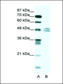 Anti-TRIP13 (AB1) antibody produced in rabbit IgG fraction of antiserum