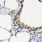 Anti-Phospho-ERK1-T202 + ERK2-T185 antibody produced in rabbit