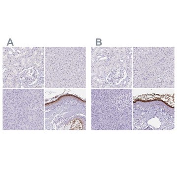 Anti-CDSN antibody produced in rabbit Prestige Antibodies&#174; Powered by Atlas Antibodies, affinity isolated antibody, buffered aqueous glycerol solution