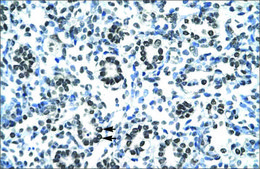 Anti-HOXB9 antibody produced in rabbit affinity isolated antibody