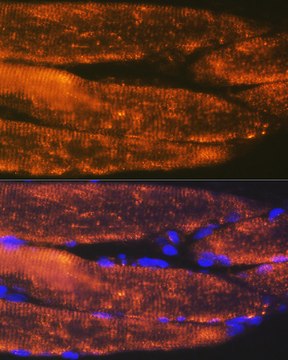 Anti-ACTN3 Antibody, clone 4H7E6, Rabbit Monoclonal