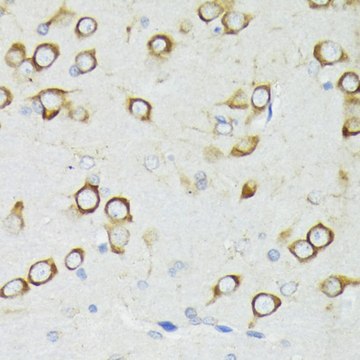Anti- PDPK1 antibody produced in rabbit