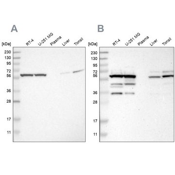 Anti-CCT8 antibody produced in rabbit Prestige Antibodies&#174; Powered by Atlas Antibodies, affinity isolated antibody, buffered aqueous glycerol solution