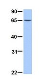 Anti-ETV5 antibody produced in rabbit affinity isolated antibody