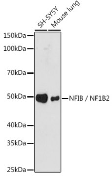 Anti-NFIB / NF1B2 Antibody, clone 7T1G5, Rabbit Monoclonal