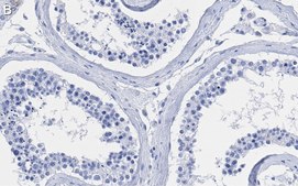 Anti-Centrin-1 Antibody, clone 5L17 ZooMAb® Rabbit Monoclonal recombinant, expressed in HEK 293 cells