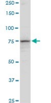 Anti-PCCA antibody produced in mouse purified immunoglobulin, buffered aqueous solution