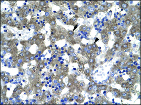 Anti-DACH2 antibody produced in rabbit affinity isolated antibody