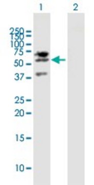 Anti-LIPG antibody produced in mouse purified immunoglobulin, buffered aqueous solution