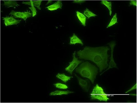 Monoclonal Anti-FLNA antibody produced in mouse clone 3B6-1D10, purified immunoglobulin, buffered aqueous solution