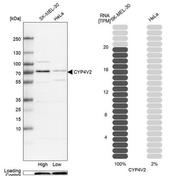 Anti-CYP4V2 antibody produced in rabbit Prestige Antibodies&#174; Powered by Atlas Antibodies, affinity isolated antibody, buffered aqueous glycerol solution