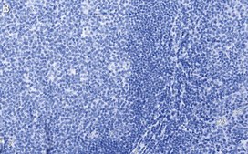 Anti-CD19 Antibody, clone 3E7 ZooMAb® Rabbit Monoclonal recombinant, expressed in HEK 293 cells