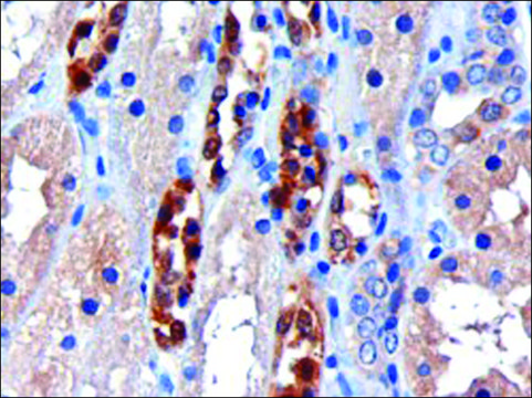 Anti-CBR1 antibody produced in goat affinity isolated antibody, buffered aqueous solution