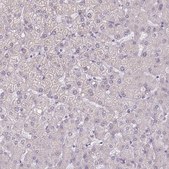 Anti-PODXL antibody produced in rabbit Prestige Antibodies® Powered by Atlas Antibodies, affinity isolated antibody, buffered aqueous glycerol solution