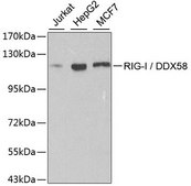 Anti-RIG-I/DDX58 antibody produced in rabbit