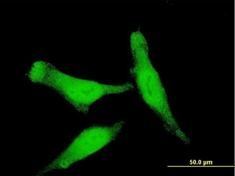 Monoclonal Anti-SMAD7 antibody produced in mouse clone 3G8, purified immunoglobulin, buffered aqueous solution