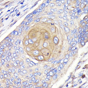 Anti-FGFR3 Antibody, clone 2V1Z6, Rabbit Monoclonal