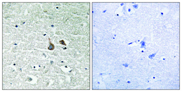 Anti-phospho-IRAK1 (pSer376) antibody produced in rabbit affinity isolated antibody