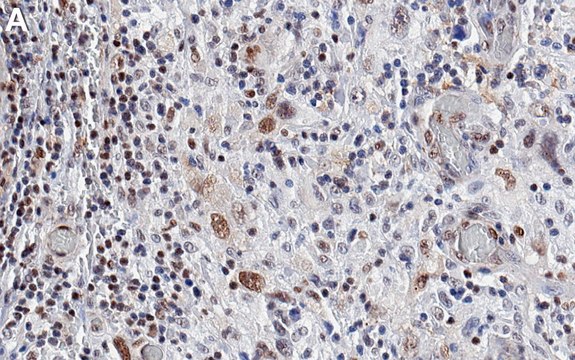 Anti-p-ATF-2-Thr69/71 Antibody, clone 1H23 ZooMAb&#174; Rabbit Monoclonal recombinant, expressed in HEK 293 cells