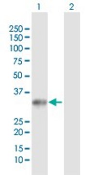 Anti-UCK2 antibody produced in rabbit purified immunoglobulin, buffered aqueous solution