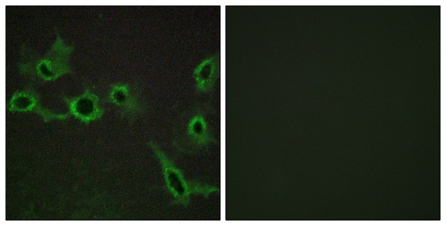 Anti-HTR7 antibody produced in rabbit affinity isolated antibody