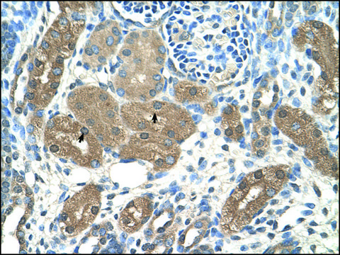 Anti-ACP1 antibody produced in rabbit IgG fraction of antiserum