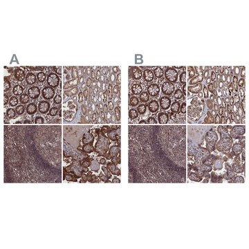 Anti-PLA2G15 antibody produced in rabbit Prestige Antibodies&#174; Powered by Atlas Antibodies, affinity isolated antibody, buffered aqueous glycerol solution