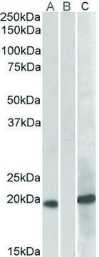 Anti-HOXA1 antibody produced in goat affinity isolated antibody, buffered aqueous solution