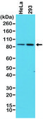 Anti-beta-Catenin 1 antibody, Rabbit monoclonal recombinant, expressed in HEK 293 cells, clone RM276, purified immunoglobulin
