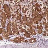 Anti-TMED6 antibody produced in rabbit Prestige Antibodies® Powered by Atlas Antibodies, affinity isolated antibody, buffered aqueous glycerol solution
