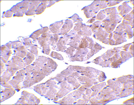 Anti-TRPC3 (ab3) antibody produced in rabbit affinity isolated antibody, buffered aqueous solution