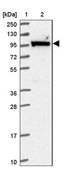Anti-MOCOS antibody produced in rabbit Prestige Antibodies® Powered by Atlas Antibodies, affinity isolated antibody, buffered aqueous glycerol solution