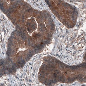 Monoclonal Anti-ST13 antibody produced in mouse Prestige Antibodies&#174; Powered by Atlas Antibodies, clone CL3708, purified immunoglobulin, buffered aqueous glycerol solution