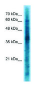 Anti-CRKL antibody produced in rabbit affinity isolated antibody