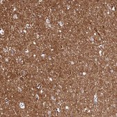 Anti-FXYD6 antibody produced in rabbit Prestige Antibodies® Powered by Atlas Antibodies, affinity isolated antibody, buffered aqueous glycerol solution