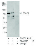 Rabbit anti-ESCO2 Antibody, Affinity Purified Powered by Bethyl Laboratories, Inc.