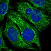 Anti-TBCA antibody produced in rabbit Prestige Antibodies® Powered by Atlas Antibodies, affinity isolated antibody, buffered aqueous glycerol solution