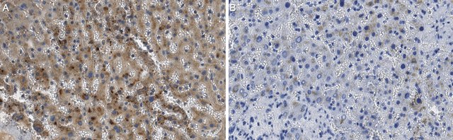 Anti-Haptoglobin Antibody, clone P2A12