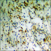 Anti-phospho-p53 (pSer20) antibody produced in rabbit affinity isolated antibody