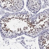 Anti-MLF1 antibody produced in rabbit Prestige Antibodies® Powered by Atlas Antibodies, affinity isolated antibody, buffered aqueous glycerol solution