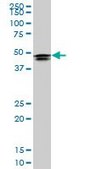 Monoclonal Anti-HOXD3 antibody produced in mouse clone 1B12, purified immunoglobulin, buffered aqueous solution