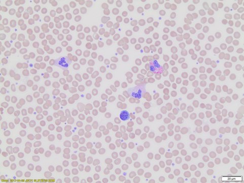 Wright-Giemsa Stain, Modified