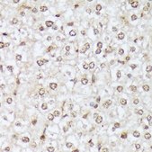 Anti-Phospho-ABL1-Y412 antibody produced in rabbit