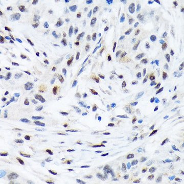 Anti-TFE3 antibody produced in rabbit