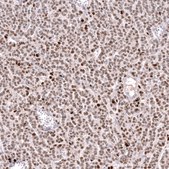 Anti-FOXL2 antibody produced in mouse Prestige Antibodies® Powered by Atlas Antibodies, clone CL12762, purified by using Protein A, buffered aqueous glycerol solution