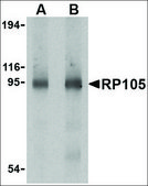Anti-RP105 antibody produced in rabbit affinity isolated antibody, buffered aqueous solution