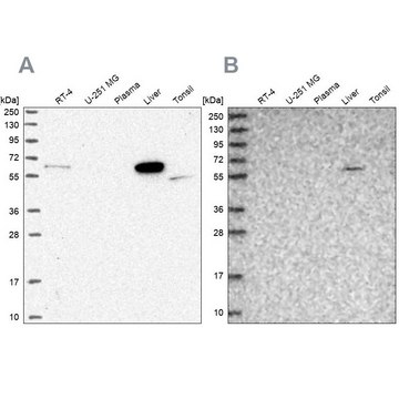 Anti-SUOX antibody produced in rabbit Prestige Antibodies&#174; Powered by Atlas Antibodies, affinity isolated antibody, buffered aqueous glycerol solution