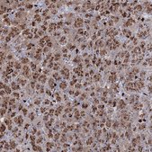 Anti-GJB5 antibody produced in rabbit Prestige Antibodies® Powered by Atlas Antibodies, affinity isolated antibody, buffered aqueous glycerol solution