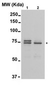 Anti-ZMYND11 Antibody serum, from rabbit